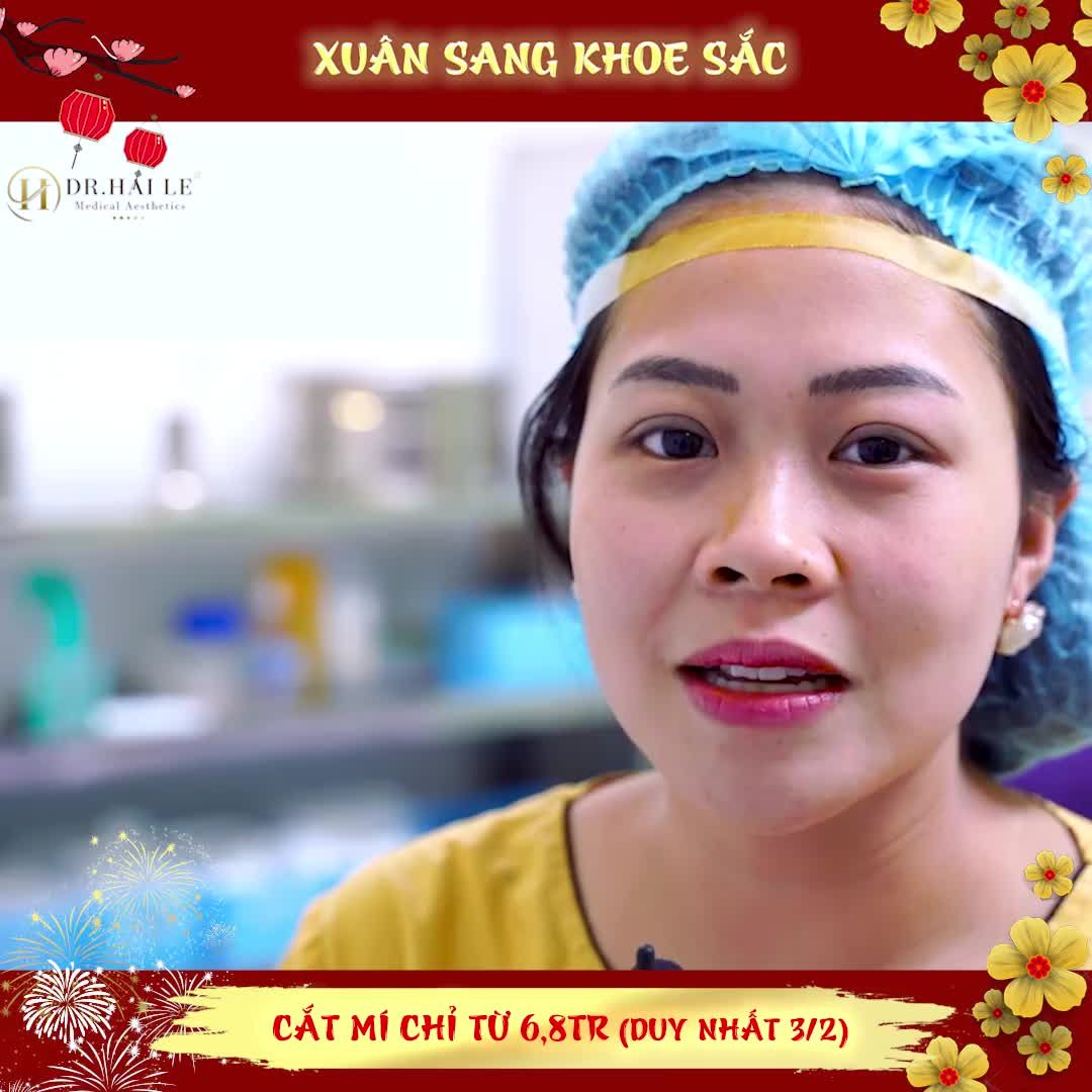 UỐNG NHẦM MỘT ÁNH MẮT – CƠN SAY THEO CẢ ĐỜI với Cắt mí MANI MINI DEEP 5D tại Dr.Hải Lê:!