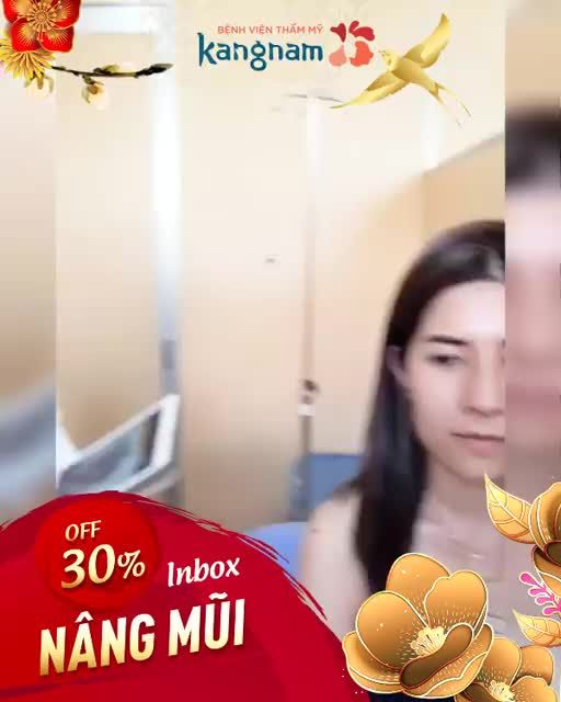 Nâng mũi cấu trúc 4D Mũi cao nâng tầm nhan sắc