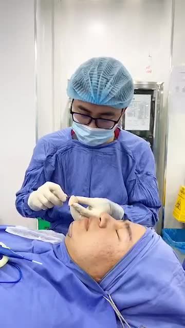 Quy trình gọt chất liệu độn cằm - tạo hình cằm Vline tại bvtm Kangnam