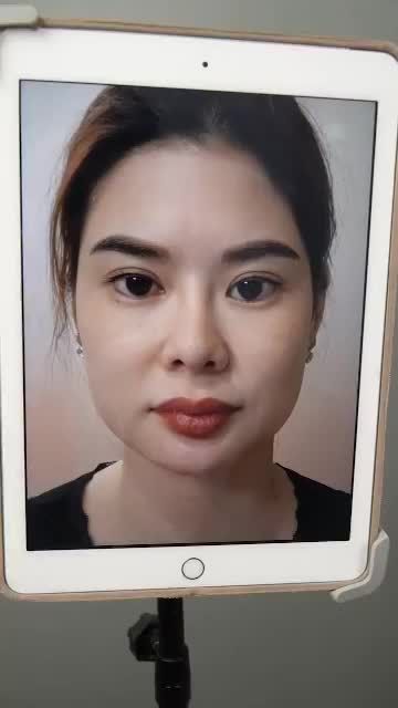 DR.HOẠT "GIẢI CỨU" THÀNH CÔNG CHIẾC MŨI ĐÃ 3 LẦN SỬA HỎNG