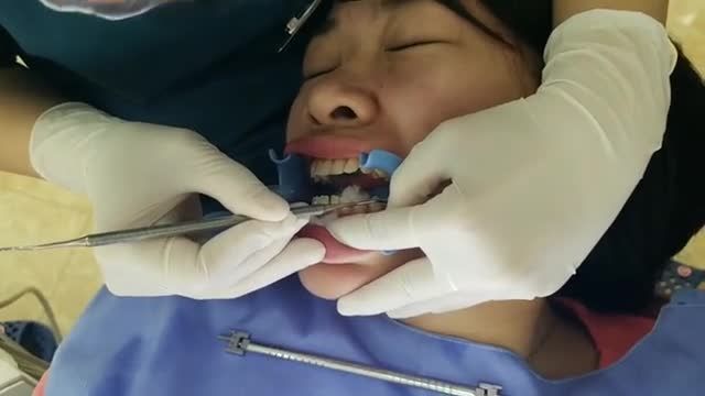 Gắn mắc cài cho chị Phương.