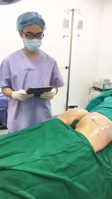 KẾT QUẢ SAU 90p THỰC HIỆN DỊCH VỤ NÂNG MÔNG BẰNG PHƯƠNG PHÁP CẤY MỠ TỰ THÂN VÀ ĐẶT CHẤT LIỆU