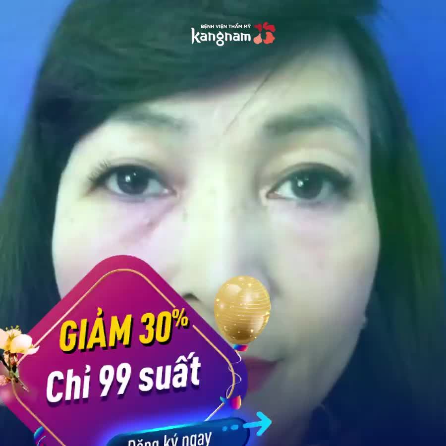Sắp TẾT Không CẮT MÍ thì còn Đợi Đến Bao Giờ