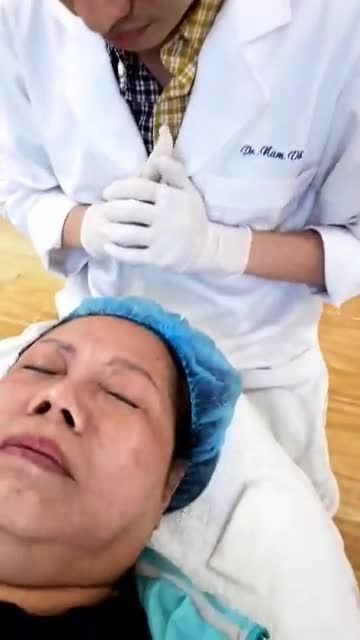 KHÁCH HÀNG ĐIỀU TRỊ MỤN THỊT BẰNG CÔNG NGHỆ LASER CO2 VI ĐIỂM