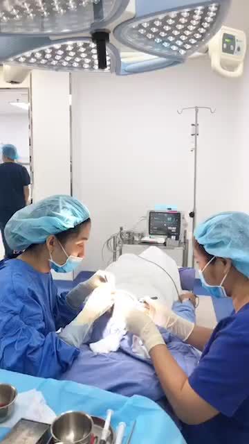 Quá trình cấy tóc tự thân cấp độ 5 cho khách hàng .