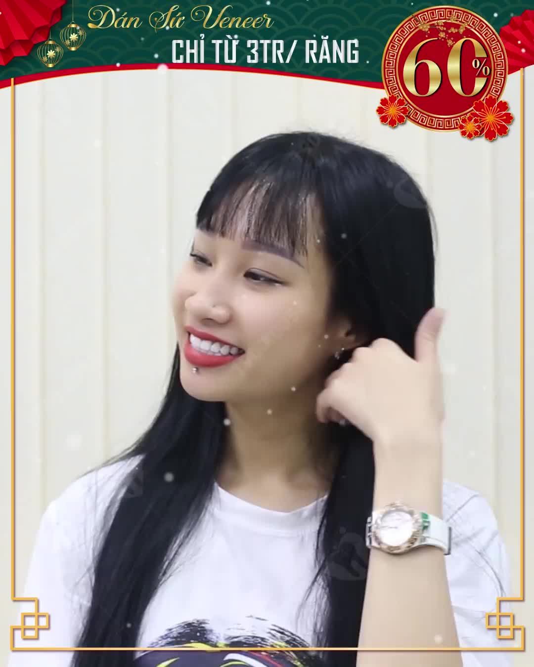 “Nếu biết trước làm răng đẹp thế này, chị đã làm từ lâu rồi chứ không để đến bây giờ”
