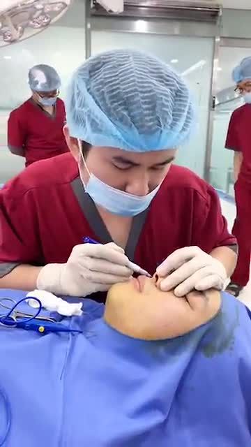 Phẫu thuật làm đẹp đón tết Quy trình cuộn cánh mũi tại BVTM Kangnam