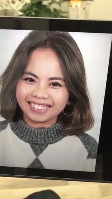 Chiêm ngưỡng kết quả khách hàng việt Kiều Hàn Quốc sau thẩm mỹ 25 răng sứ Nacera chuẩn Đức