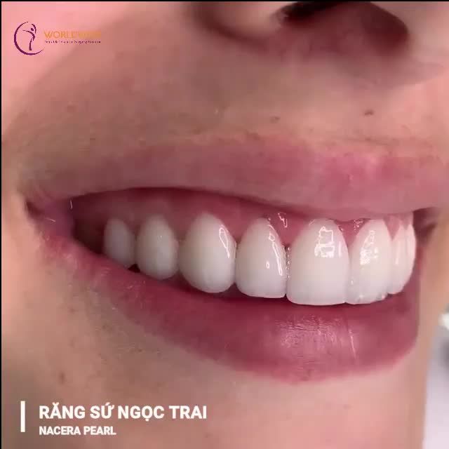 ZOOM - IN CẬN CẢNH RĂNG SỨ NGỌC TRAI CÓ TẠI NhakhoaDrHung