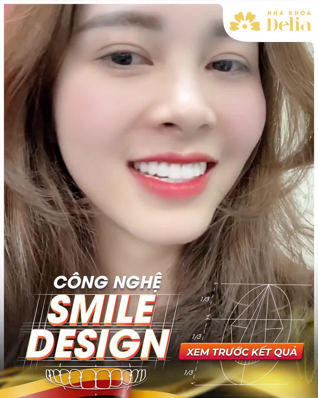 Delia - Đối tác chiến lược của hãng sứ cao cấp HT Smile của Đức, là nha khoa quốc tế hàng đầu Việt Nam.