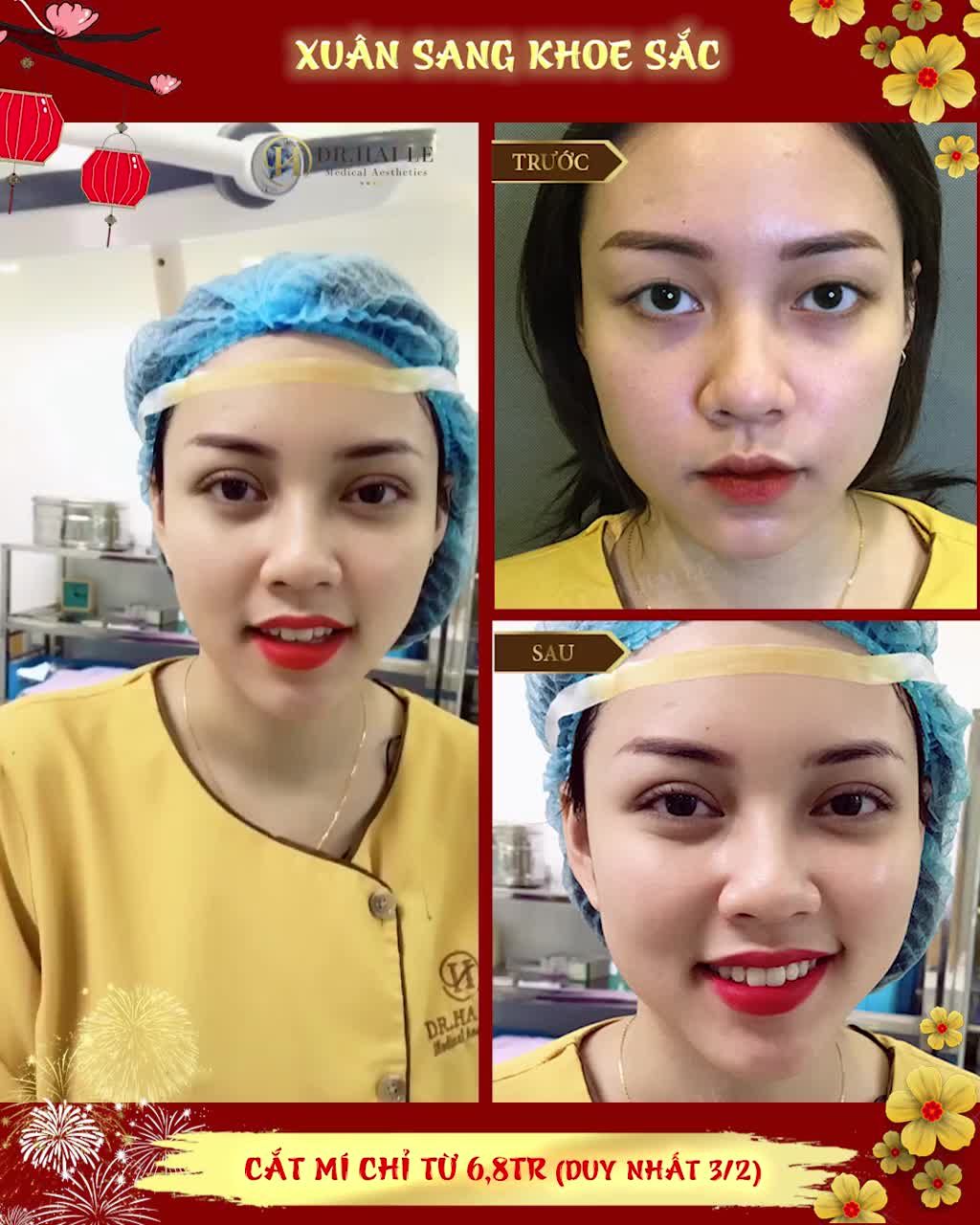 MUỐN CÓ "MẮT BIẾC" GIỐNG CÔ GÁI NÀY THÌ CẮT MÍ MANI MINI DEEP 5D NGAY THÔI!