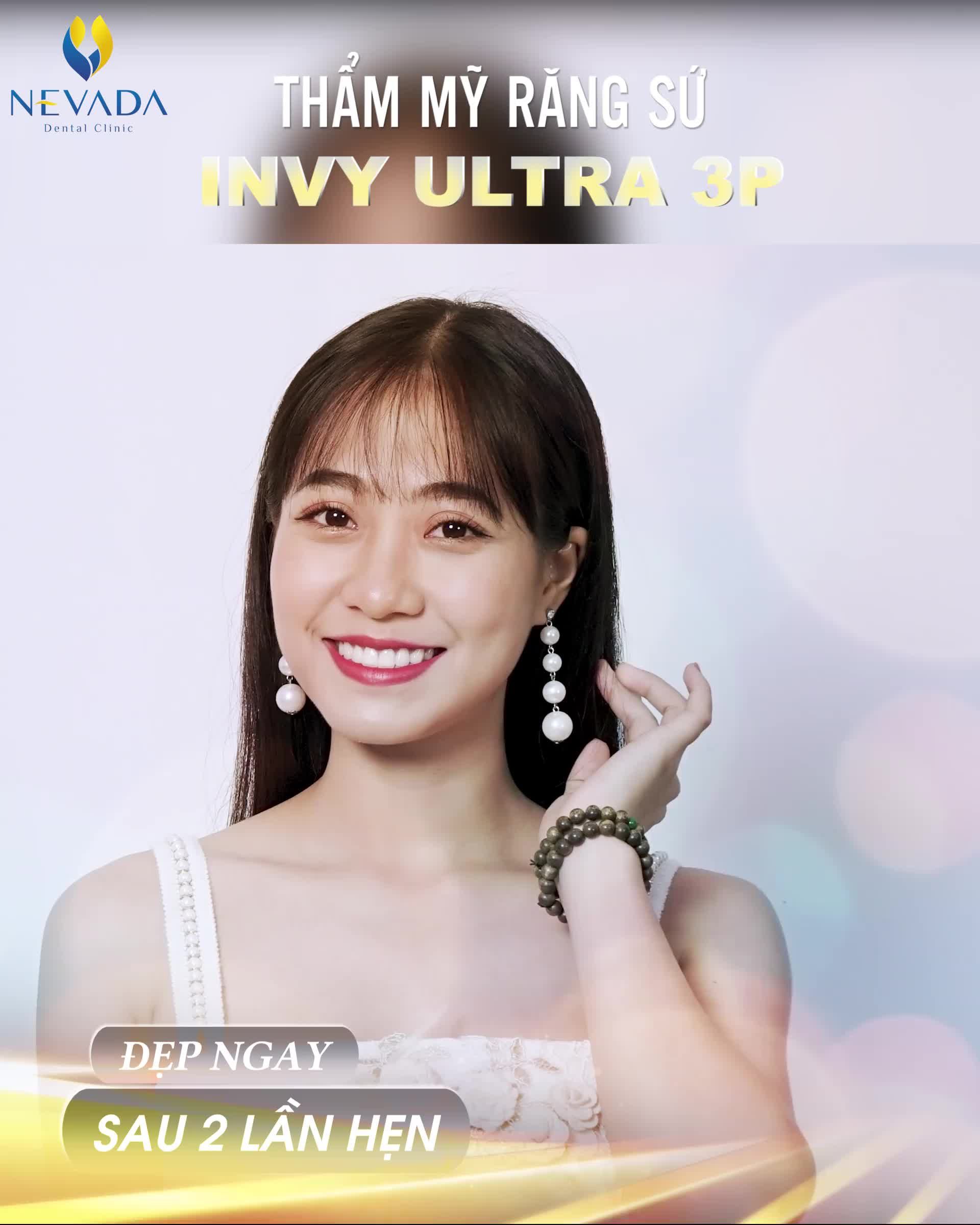 RĂNG KHẤP KHỂNH - SỨT MẺ - XỈN MÀU CHẤM DỨT HOÀN TOÀN SAU 2 BUỔI HẸN