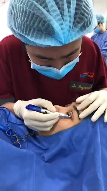 Phân tích, đo vẽ cá sẽ khách hàng Cắt mí trên Plasma