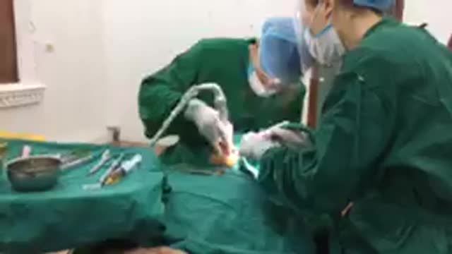 Cấy chân răng nhân tạo số 7 cho chú Mới tại Nha Khoa Thuỳ Anh.