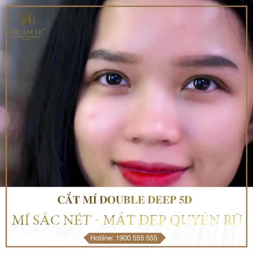 CÓ NHIỀU CÁCH ĐỂ TRỞ NÊN XINH ĐẸP NHANH CHÓNG - NHƯNG ĐƠN GIẢN NHẤT VẪN LÀ CẮT MÍ THẨM MỸ !