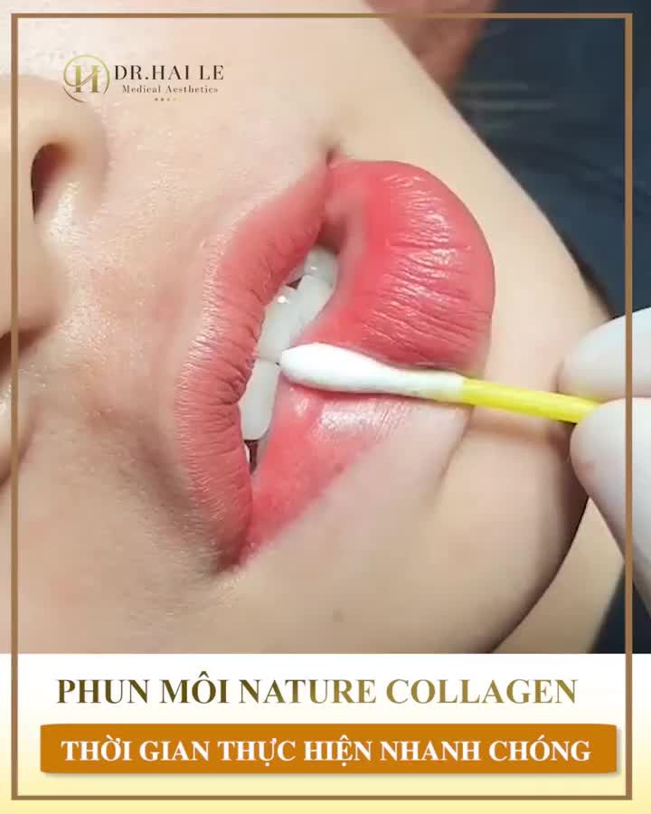MÔI THÂM, NHỢT NHẠT THIẾU SỨC SỐNG. PHẢI LÀM SAO