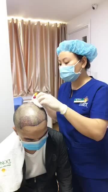 Quá trình thay băng tóc tại bệnh viện thẩm Mỹ Đông Á