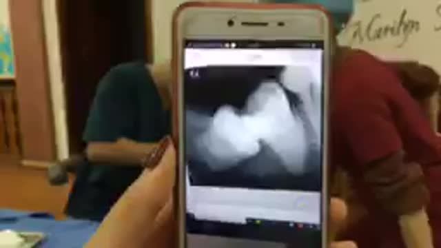 Nhổ răng khôn mọc lệch cho anh Tùng.