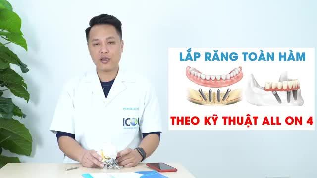 CA LẮP RĂNG TOÀN HÀM BẰNG KỸ THUẬT ALL - ON - 4