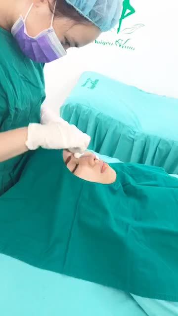 NÂNG MŨI SIÊU CẤU TRÚC CẢI THIỆN DÁNG MŨI THẤP