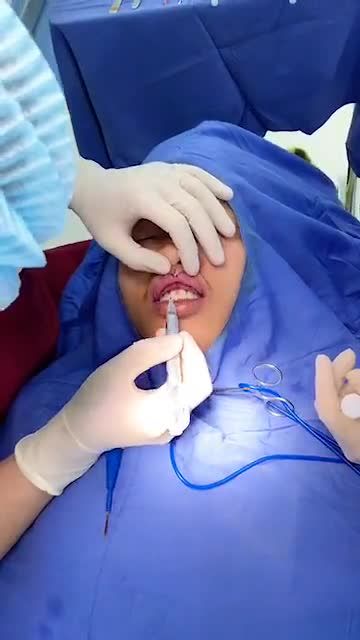 Ao ước MÔI TRÁI TIM Đo Vẽ thế nào ra DÁNG MÔI CHUẨN?