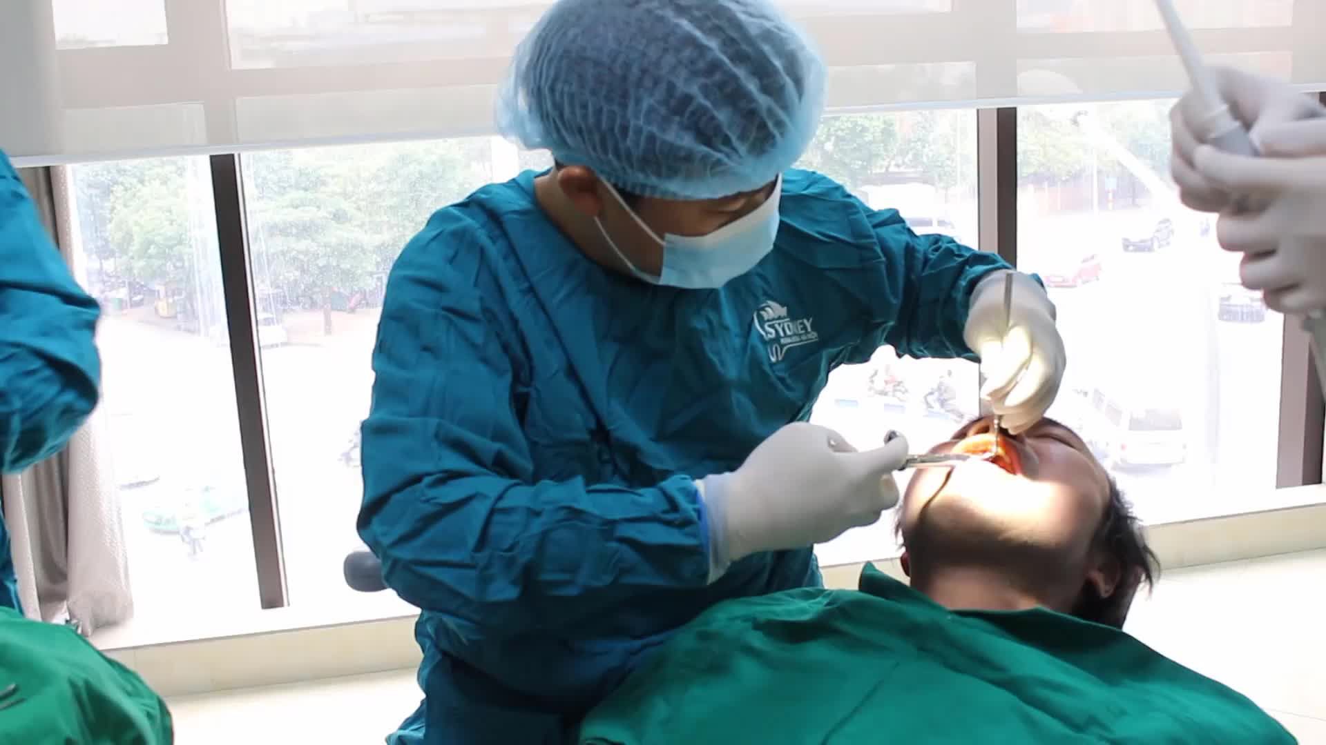 Case cấy ghép trụ implant cho bệnh nhân T. Q. N - 52 tuổi ở Ba Vì - Hà Nội