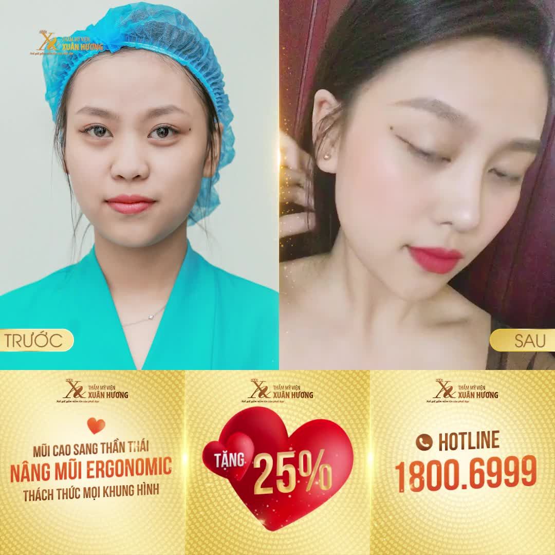TÂN TRANG NHAN SẮC VỚI GỢI Ý LỰA CHỌN DÁNG MŨI TỪ TMV XUÂN HƯƠNG