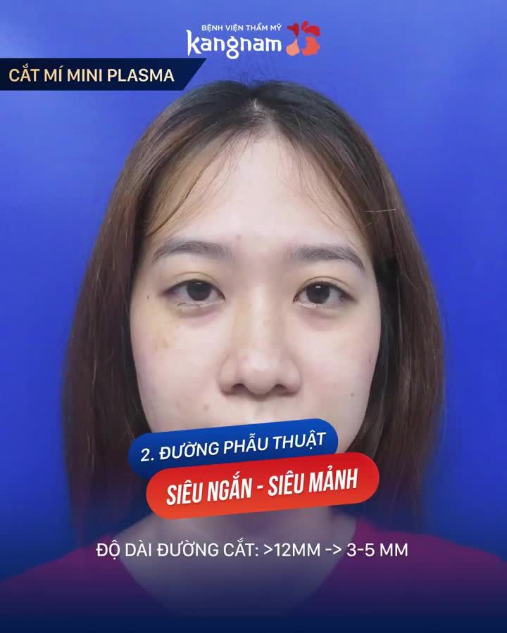 Cập nhật ngay XU HƯỚNG CẮT MÍ 2020!!!