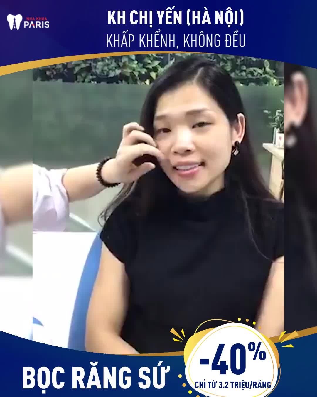 "Tạm biệt" Răng Khấp Khểnh, Mất Răng, Hình Thể Không Đều do bọc composite hỏng