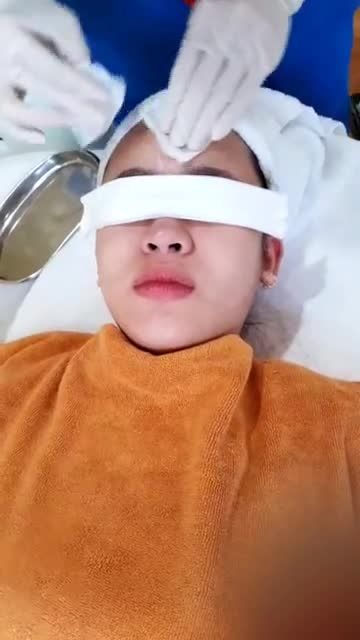 "ĐÁNH BAY" mụn lâu năm chỉ từ 0Đ  Duy nhất Tuần vàng điều trị da