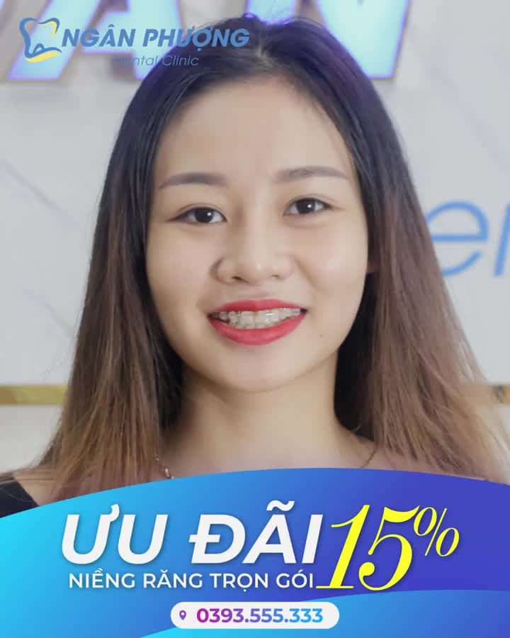 5 LÝ DO KHIẾN BẠN NHẤT ĐỊNH CẦN NIỀNG RĂNG