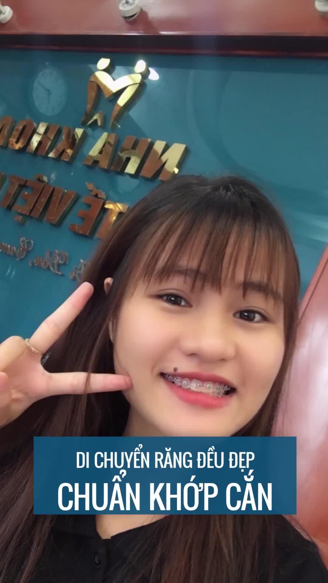 HÓT HÓT CƠ HỘI NIỀNG RĂNG KHÔNG THỂ BỎ LỠ