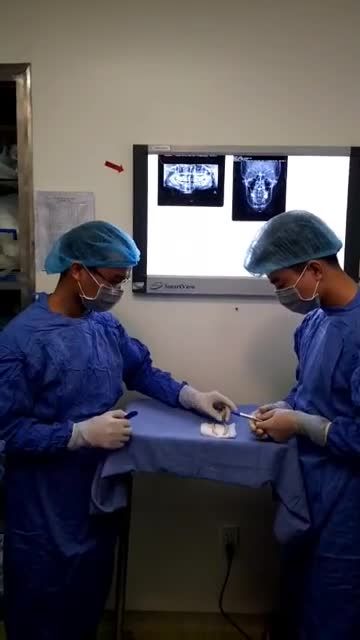 Kết quả GỌT GÓC HÀM ngay tại phòng đại phẫu BVTM Kangnam!
