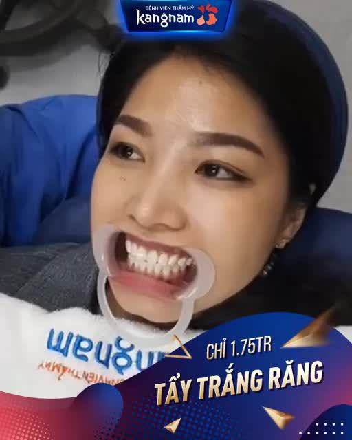 Đến Kangnam - Có Răng Trắng Cười Sang sau 30 PHÚT