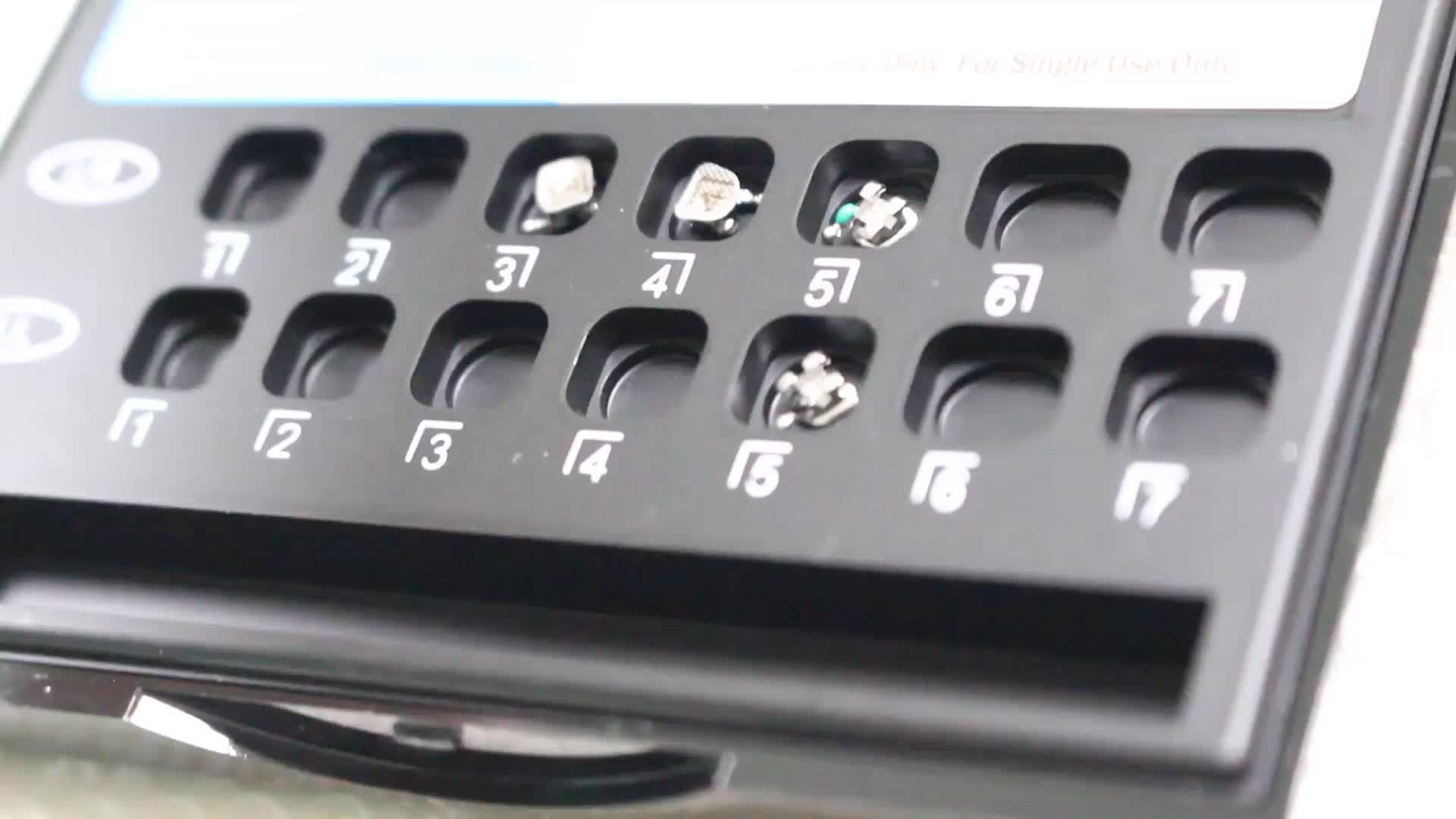 Case gắn mắc cài kim loại cho bệnh nhân L. Q. N - 13 tuổi ở Hà Đông