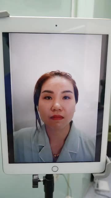 DR.HOẠT TÁI TẠO LẠI DÁNG MŨI MỚI CHO KHÁCH ĐÃ TỪNG SỬA MŨI NƠI KHÁC NHƯNG BI HỎNG