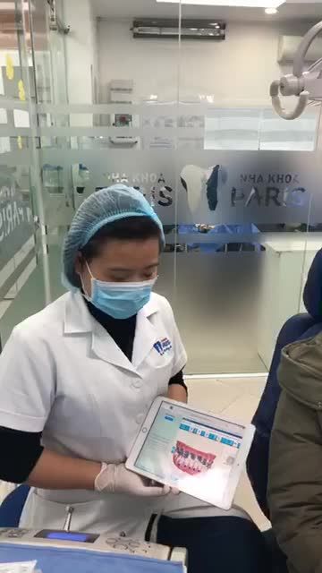 KH chỉnh nha khay trong sau 6 tháng tại nha khoa Paris Quang Trung Hà Nội