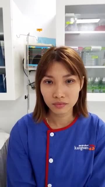 KHÁCH HÀNG CẮT MÍ TRÊN PLASMA