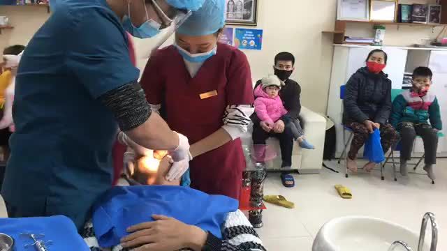 Nhổ răng 28 mọc trồi khi không có răng đối diện gây cản trở khớp cắn.