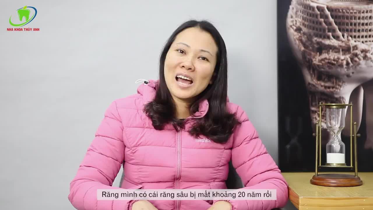 CHÂN RĂNG NHÂN TẠO IMPLANT - ĐEM LẠI CẢM GIÁC ĂN NHAI THOẢI MÁI CHO KHÁCH HÀNG.