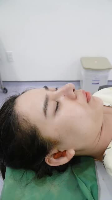 NÂNG MŨI CẤU TRÚC - MŨI ĐẸP CUỐN HÚT NGAY KHI VỪA THỰC HIỆN XONG