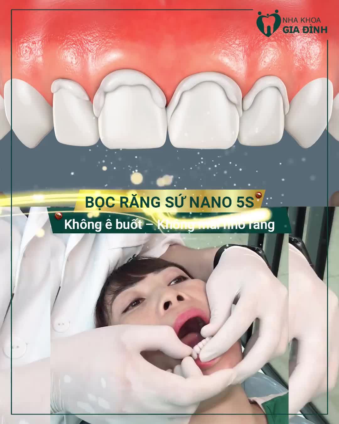 THAY ĐỔI NỤ CƯỜI – TOẠI NGUYỆN ƯỚC MƠ
