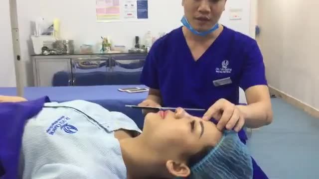 Bác sĩ Vũ Quang trực tiếp xử lý CA MŨI HỎNG SAU 3 LẦN NÂNG  Mời cả nhà cùng ngắm nhìn kết quả của Bác sĩ cùng ekip nhé