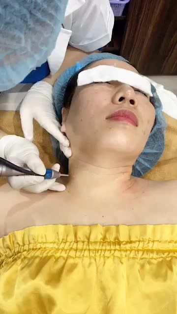 Điều trị MỤN THỊT OFF 30% - Dịp KHAI XUÂN