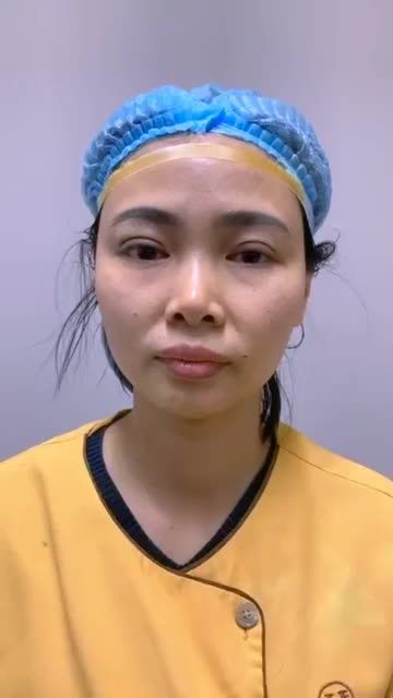 Mí khó tới đâu Dr.Hải Lê cũng XỬ LÝ được hết❗