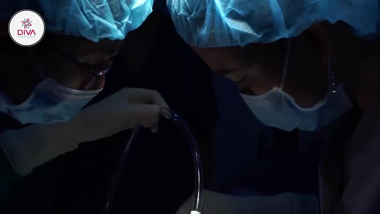 GƯƠNG MẶT THAY ĐỔI RA SAO SAU LẤY TÚI MỠ MÁ?