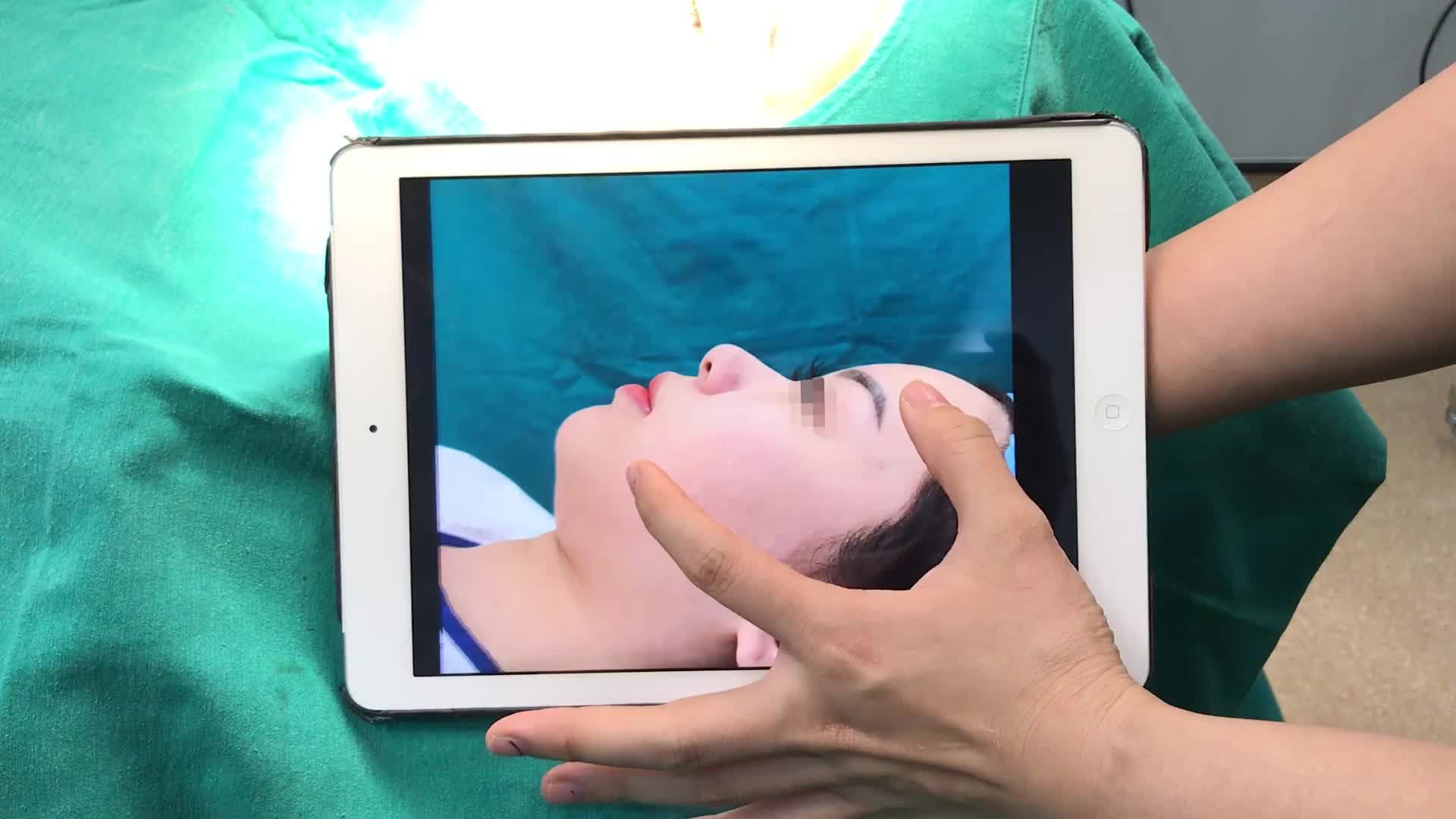 Một dáng mũi với rất nhiều khuyết điểm đã “lột xác” như thế nào?