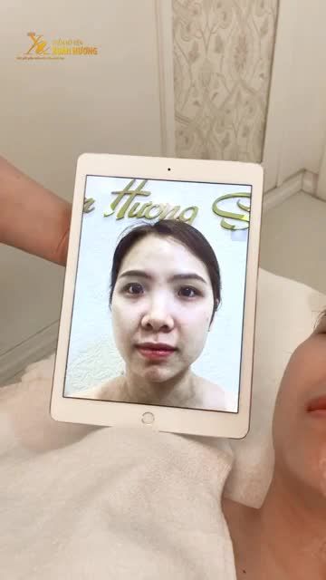 KHÔNG CHĂM SÓC THƯỜNG XUYÊN KHIẾN DA TỔN THƯƠNG?