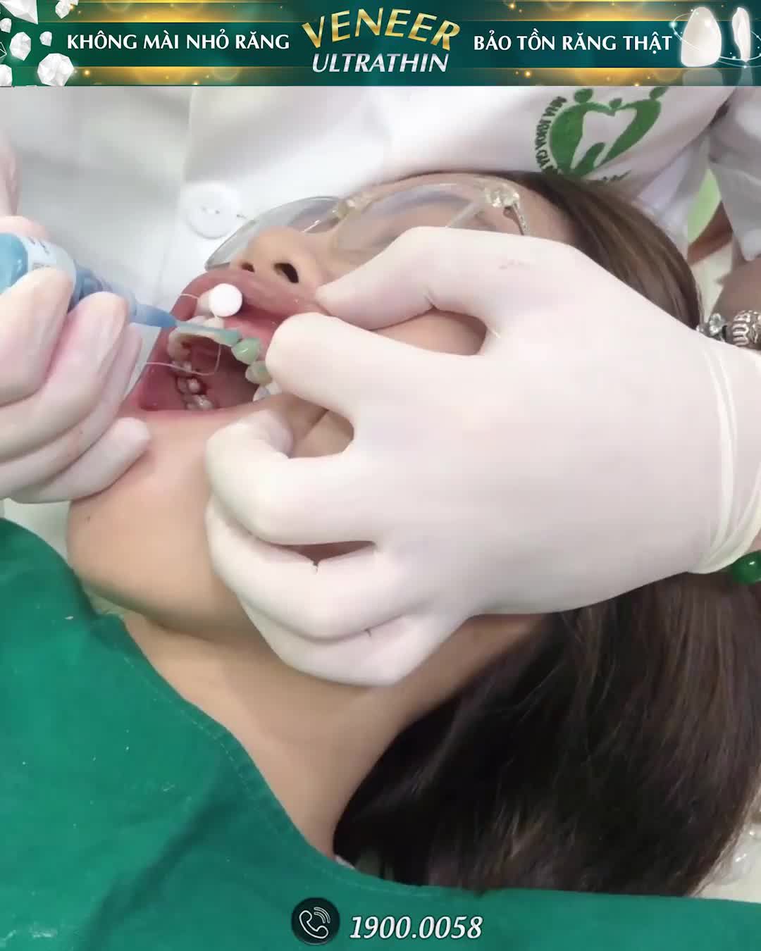 THẨM MỸ RĂNG HẠNH PHÚC NGẬP TRÀN