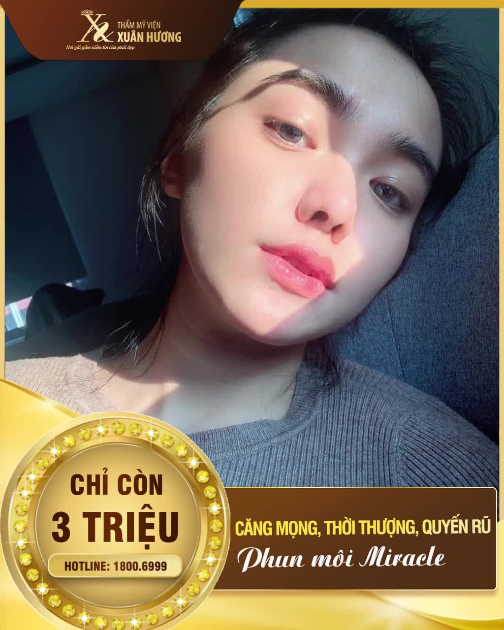 KIỂM CHỨNG CÂU CHUYỆN CÓ THẬT TẠI XUÂN HƯƠNG PHUN MÔI KHÔNG SƯNG ĐAU - ĐẸP SAU 3 NGÀY